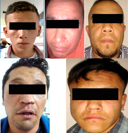 ratas neza